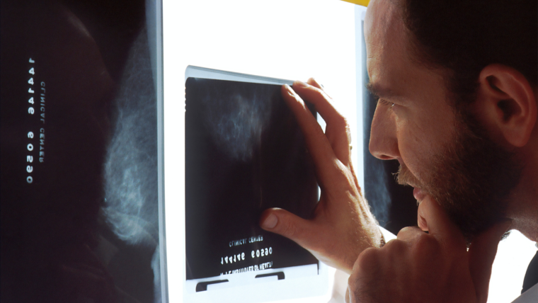 Doctor looking at a mammogram scan of a breast