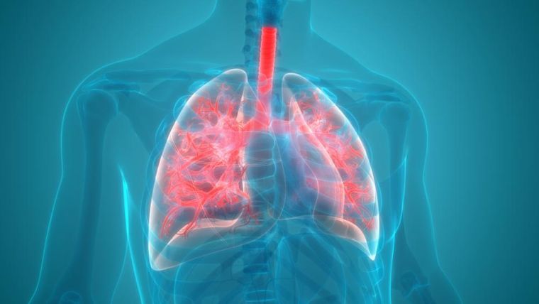 Lung cancer highlighted in the body