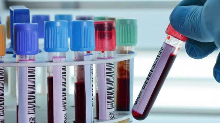 Various blood samples in test tubes